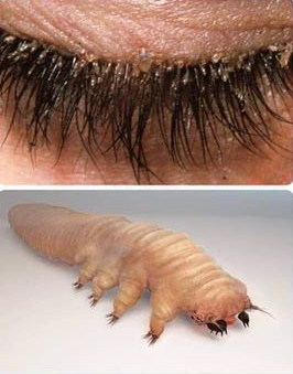 itchy eyes